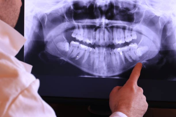 Best Cracked Tooth Emergency Dentist  in Lexico, CA
